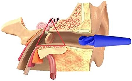 eeears Opakovane použiteľný silikónový čistič uší 2 ks
