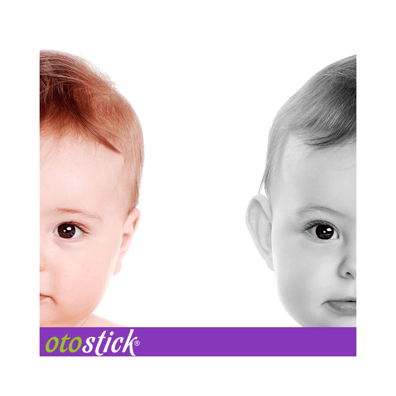 Otostick Baby - Korektor odstávajúcich uší - zvýhodnené dve balenia