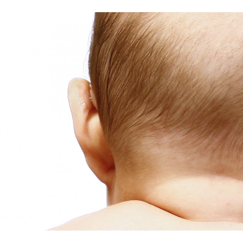 Otostick Baby - Korektor odstávajúcich uší - zvýhodnené dve balenia