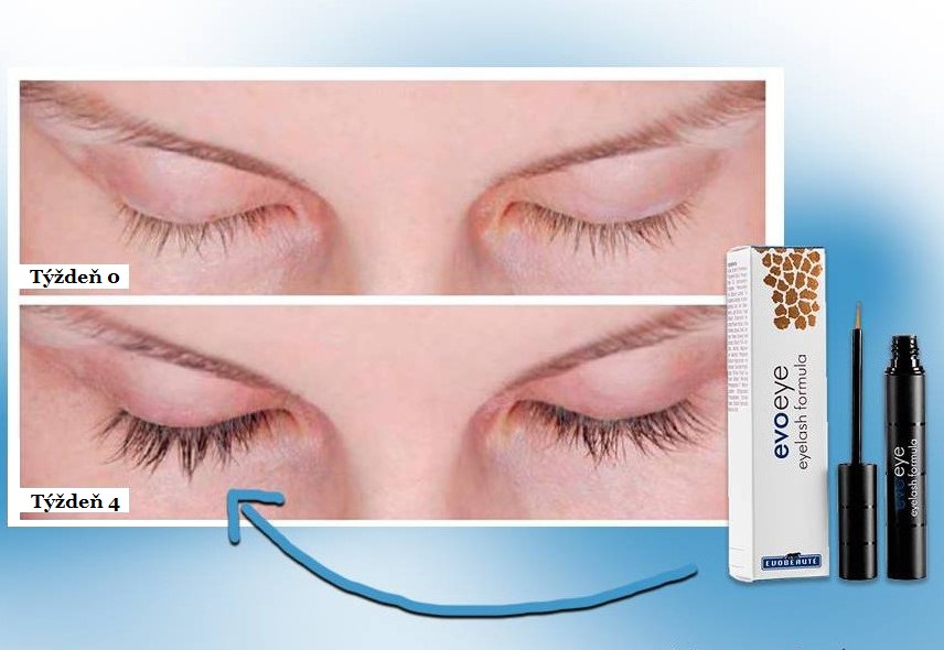 Evoeye kúra na mihálnice 3 ml