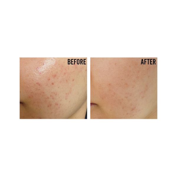 Beauty Of Joseon Relief Sun Rice + Probiotics ochranný pleťový krém s probiotikami SPF50+ 50 ml