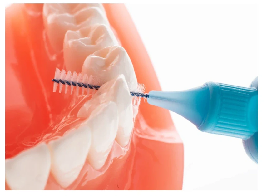 TePe Original medzizubné kefky 0,6 mm 25 ks